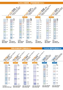 生工生物蛋白marker加強版限時促銷——優(yōu)質生命科學產品與技術服務助力科研創(chuàng)新